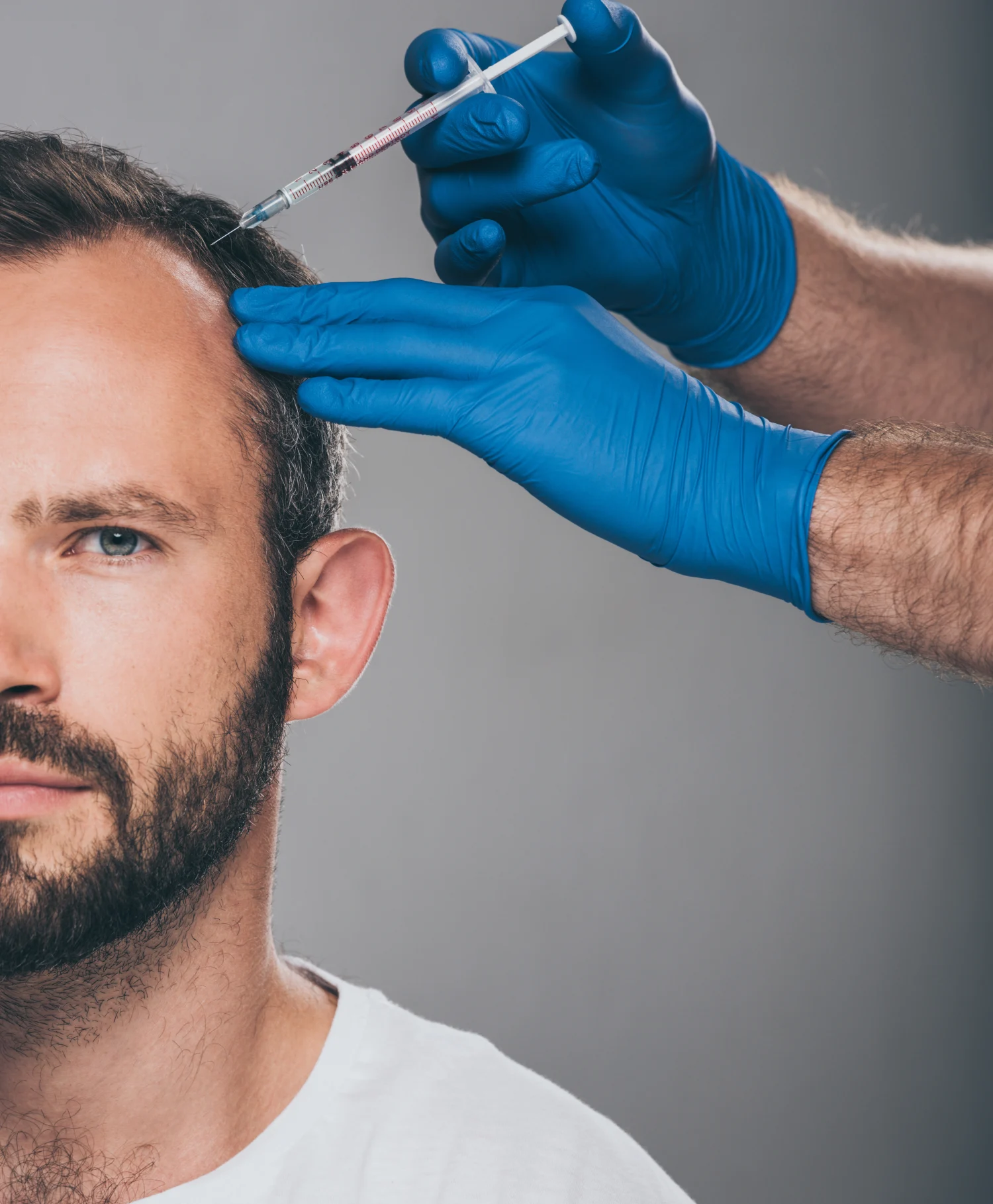 Vampire Hair Restoration® - Elite Medical Spa