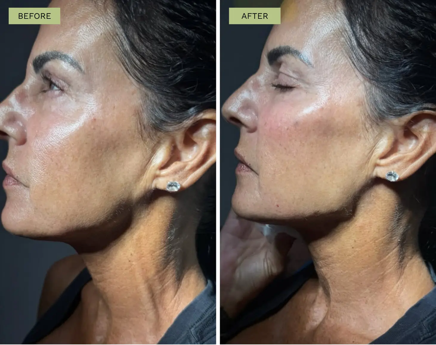 Elite Facial Balancing - Melanie Hartsell